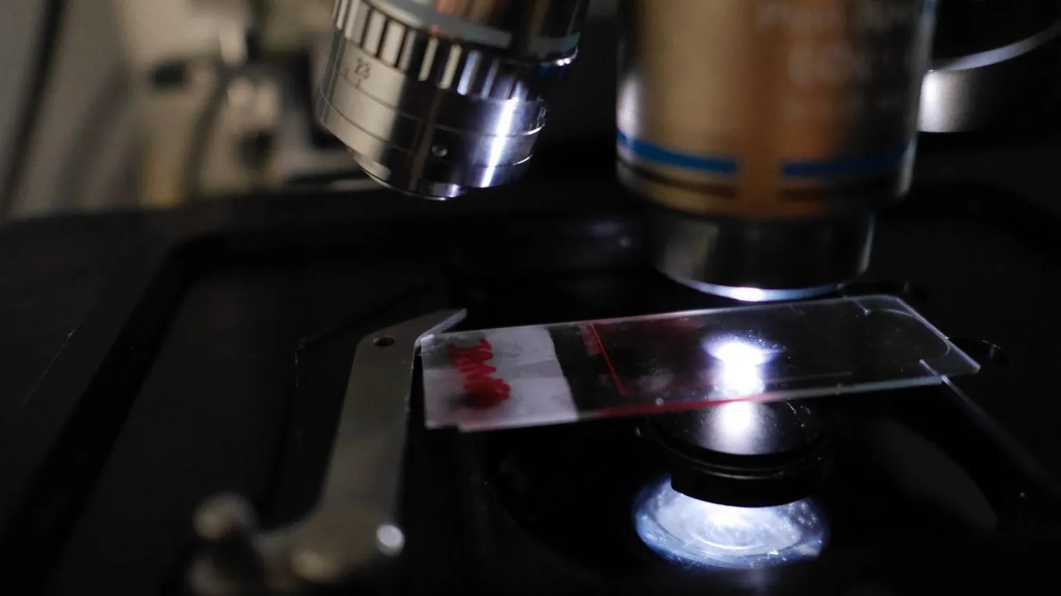 Tom Bonnett The clear sheet of glass containing the streak of blood is 