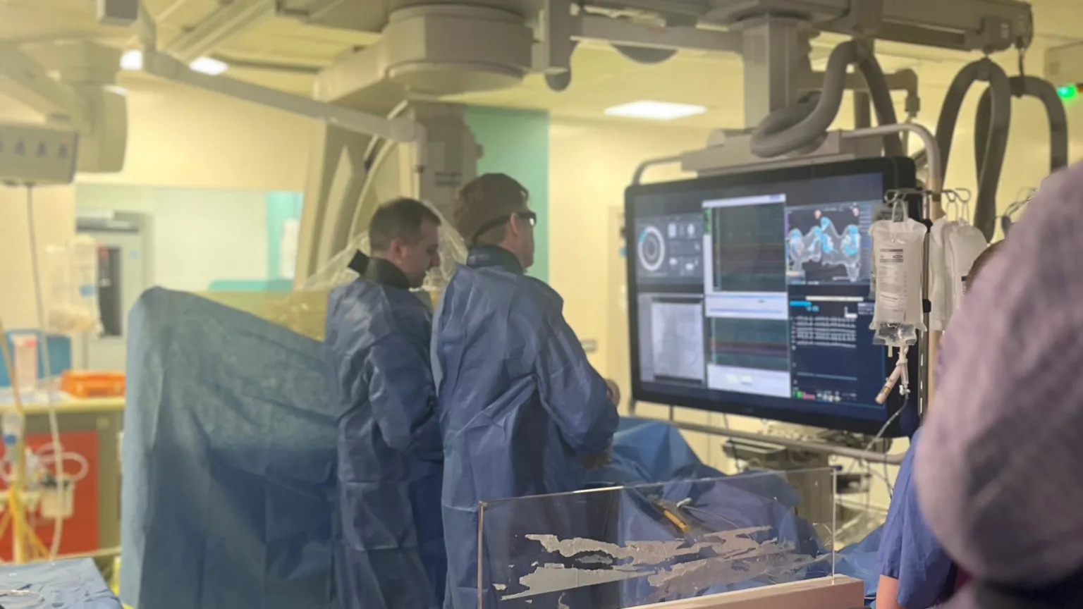 Surgeons performing the Volt Pulsed Field Ablation System in a theatre. There are two people in blue scrubs and a monitor with layouts and graphs on the screen. 