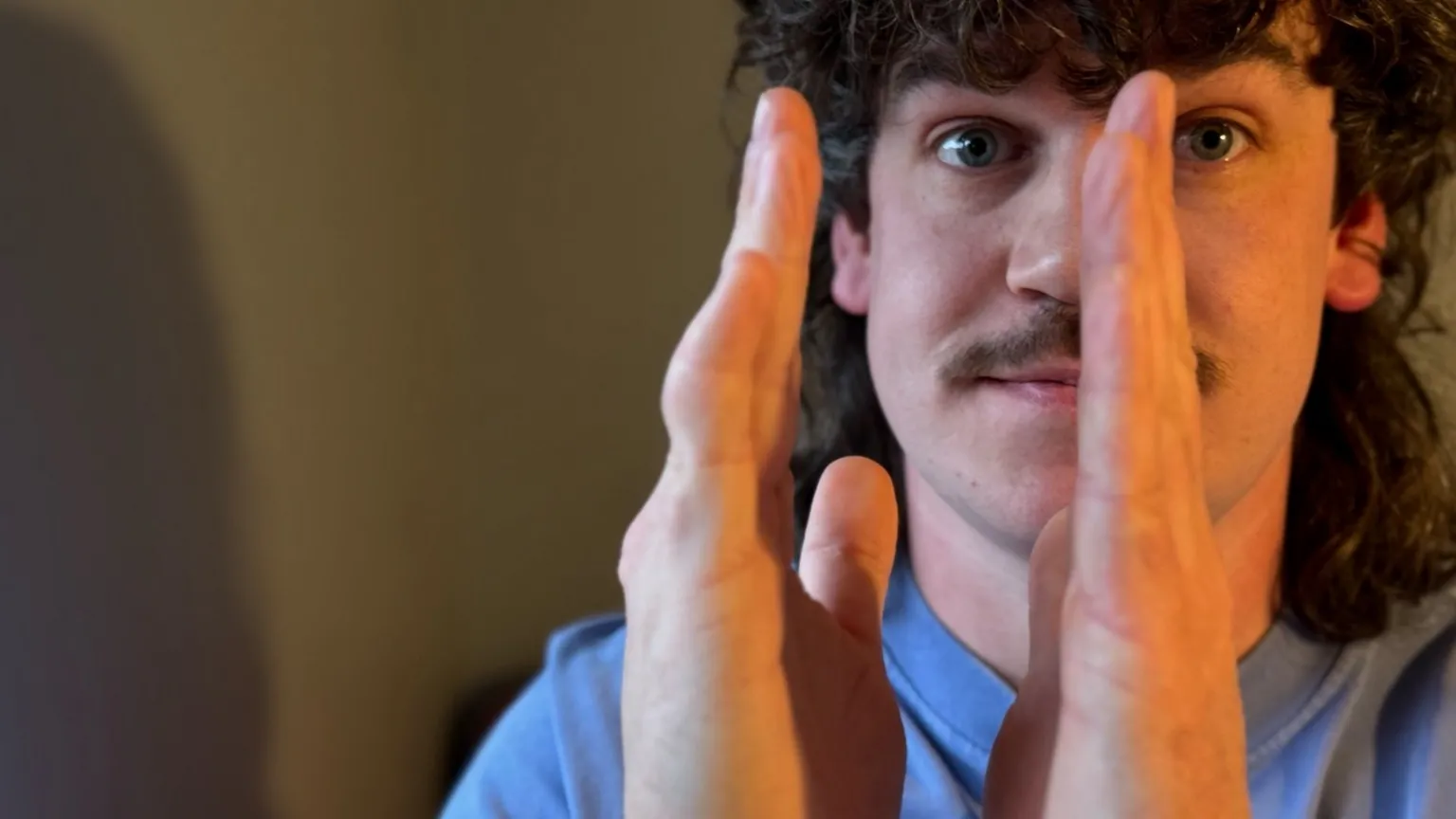 Stephen is holding his hands up in front of his face to show how the injury has affected his finger. His palms are facing each other about 3 inches apart. The little finger on his right hand is considerably shorter than the one on his left hand. It is also bent outwards. 