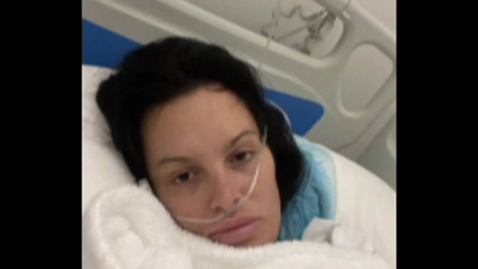 Handout A woman with dark hair lying in a hospital bed. She has a breathing tube inserted into her nose.