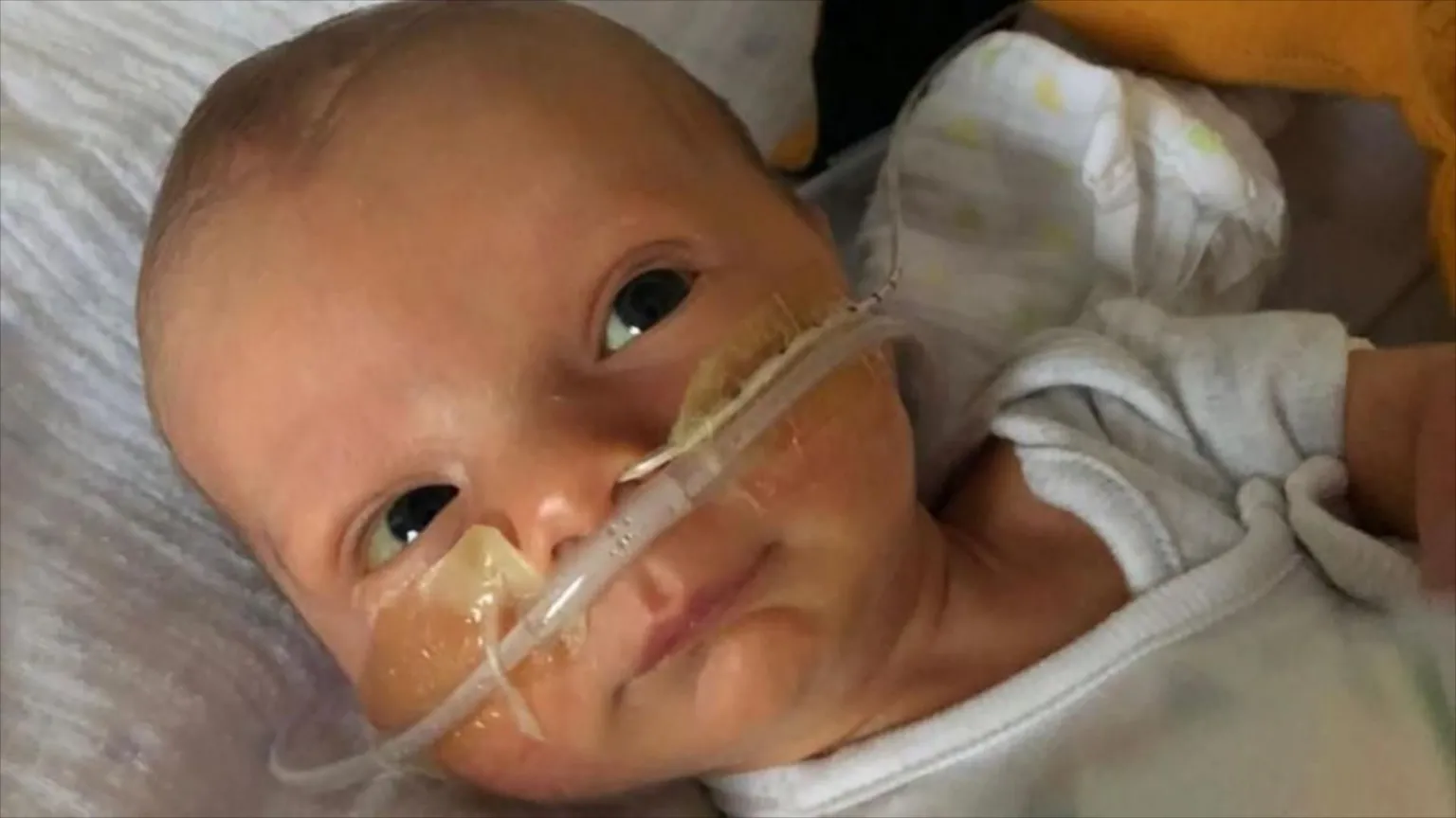 Family handout Newborn Orlando Davis, with his eyes open and a breathing tube attached to his nose with clear tape. He is wearing a white babygrow and his head is rested on what appears to be a white muslin cloth