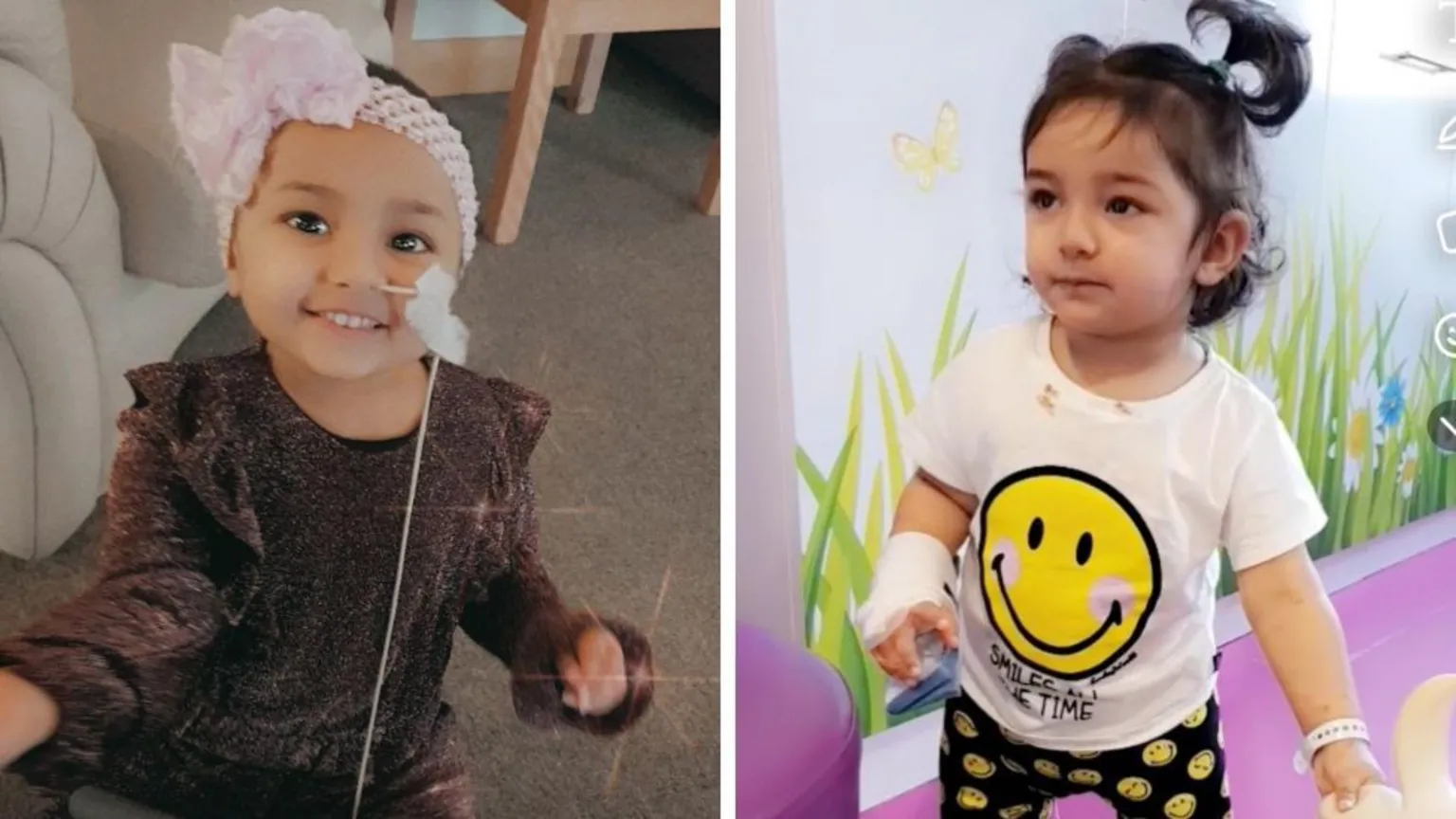 Aneeka Sohrab Two side-by-side images of a small girl with dark hair. She has medical tubes and bandages on. 