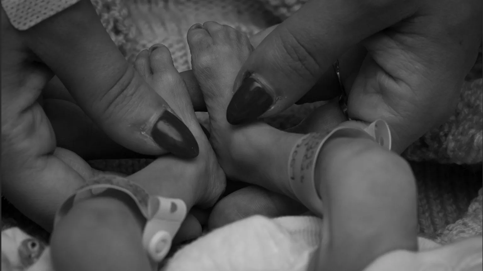 Claire Saye A woman's fingers hold on to a newborn baby's legs and feet. The woman has dark painted nails and the baby has white hospital identification bracelets around both legs. The photo is in black and white.