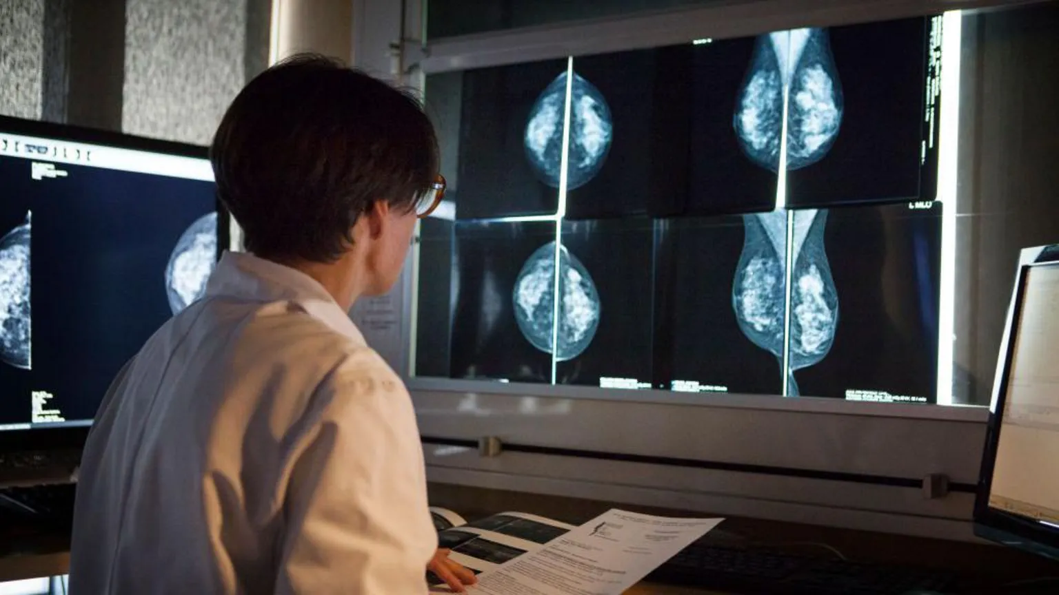 A female doctor faces away from us, looking at a large display screen showing mammogram scans.