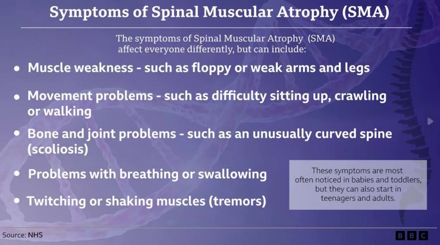 A graphic showing the symptoms of Spinal Muscular Atrophy (SMA). The background is purple and there are five bullet points in white text. The headline reads: Symptoms of Spinal Muscular Atrophy (SMA). Under this it says: 