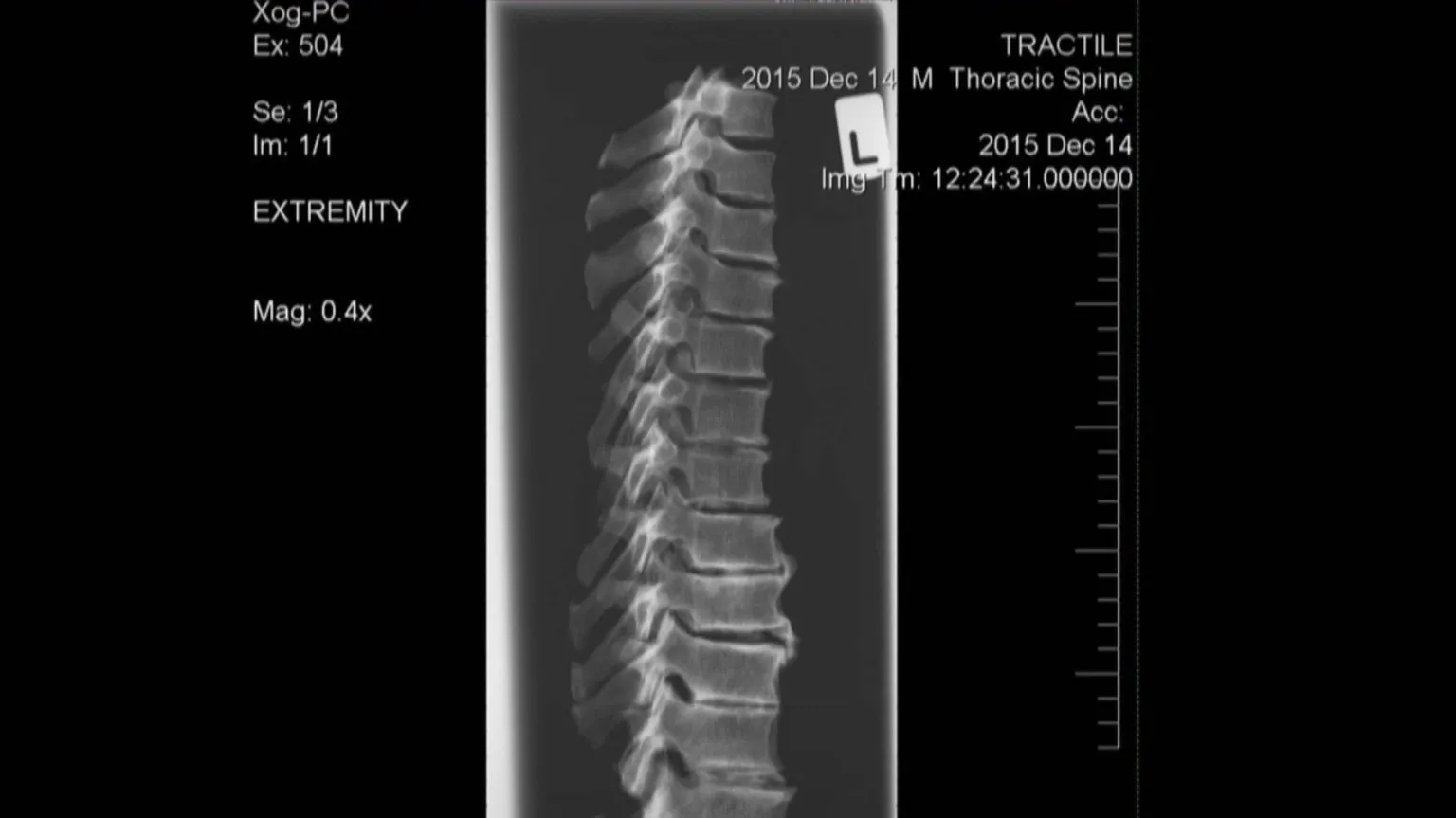 North Wales Police a spinal X-ray