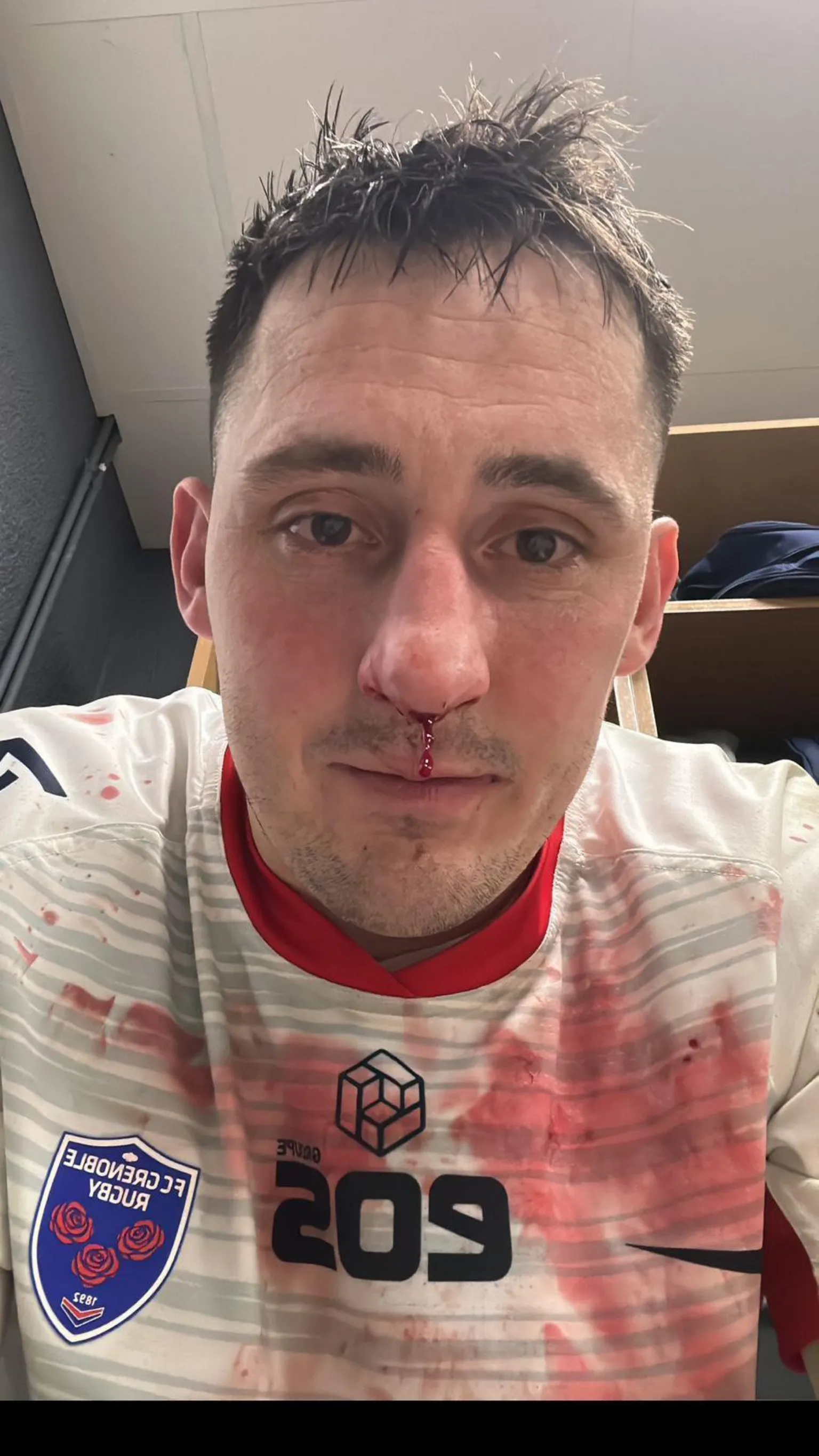 Sam Davies Sam Davies in a bloodied Grenoble rugby jersey 