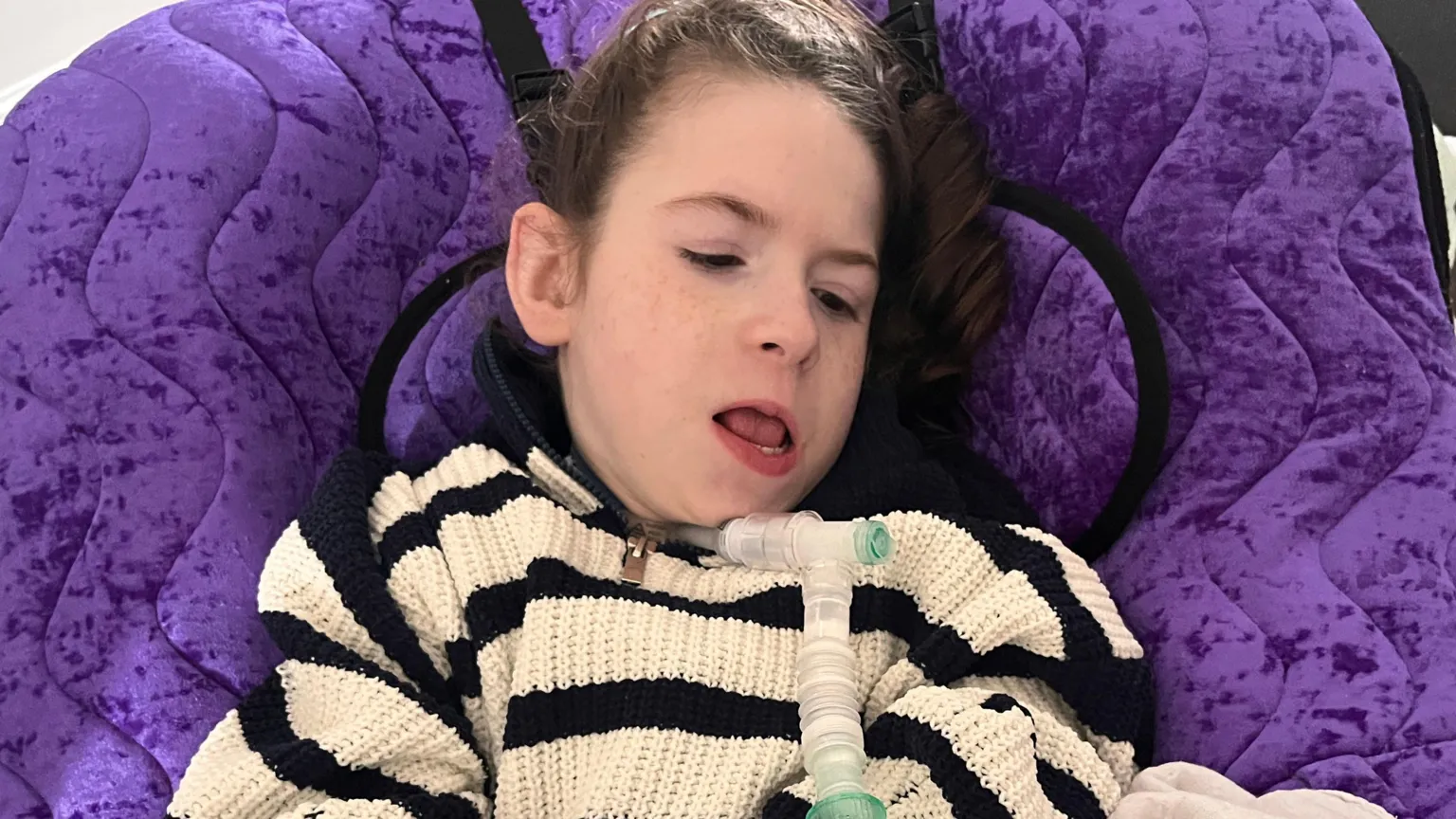 Brown haired 9 year old Thea is sitting on a purple velvet chair. Ventilator and feeding tube coming out of her neck. Wearing a cream and black striped jumper.