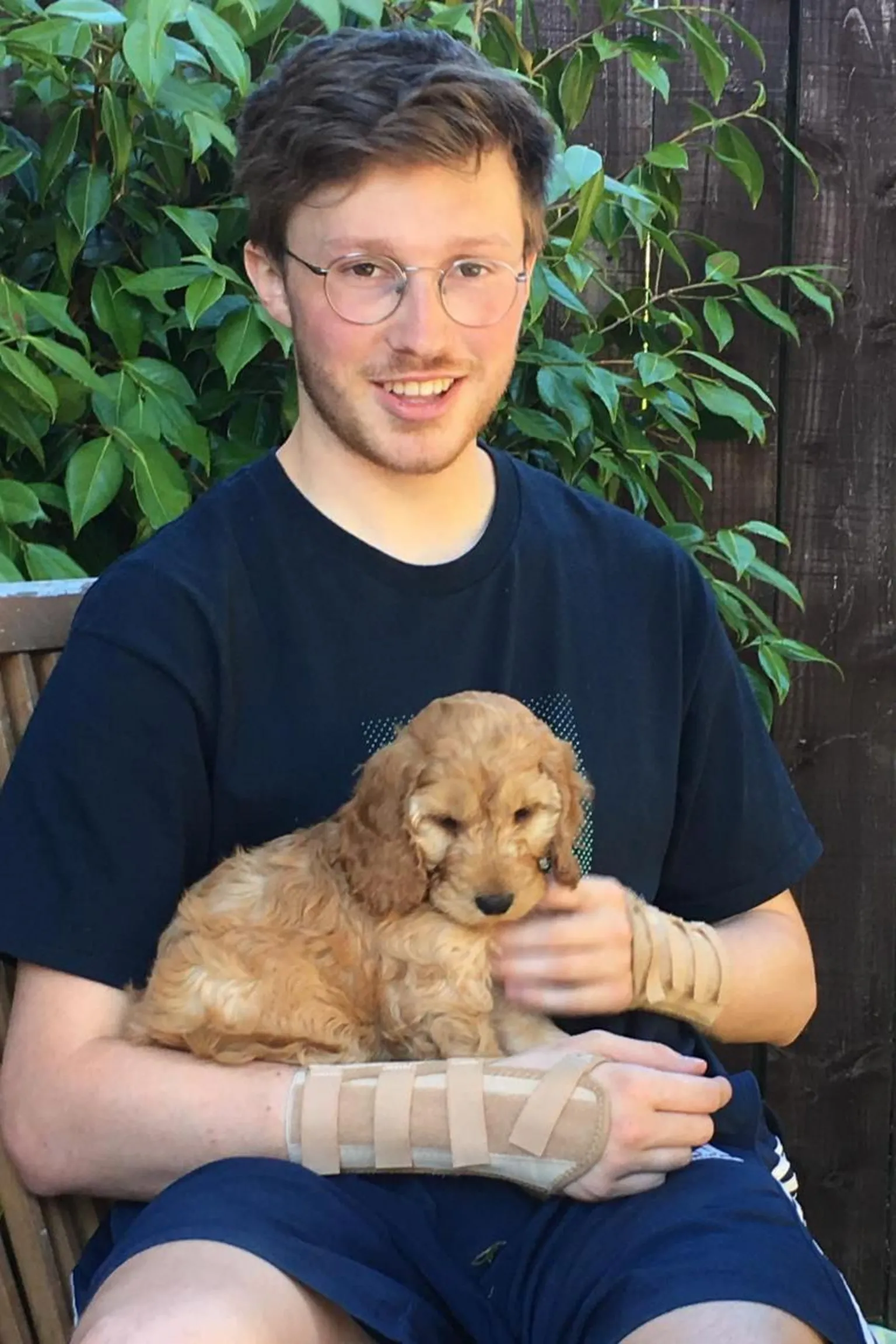 Fergal Mackie Fergal Mackie wearing two casts on both of his wrists, holding a dog. He is wearing glasses and a dark coloured t-shirt and shorts.