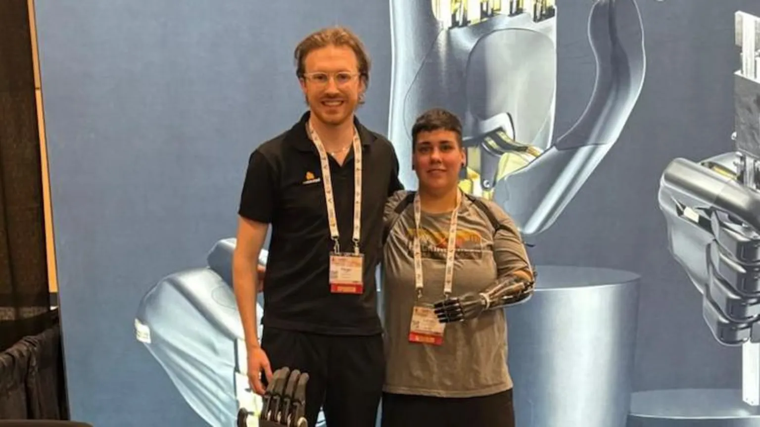 Fergal Mackie Fergal Mackie with an amputee who has received the prosthetic. 