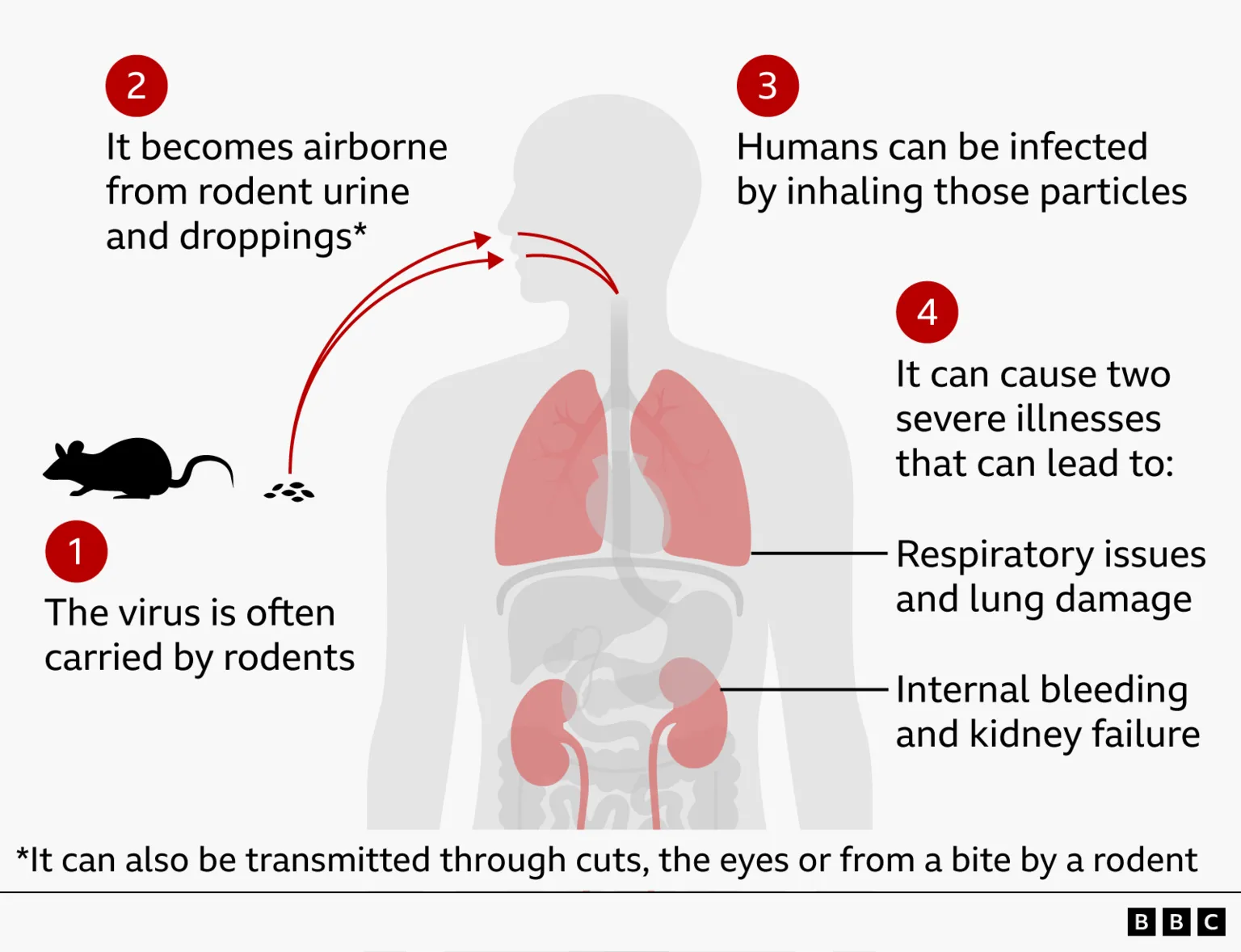 Graphic explaining how hantavirus can be transmitted to humans. Step one shows a rodent, labelled as a common carrier of the virus. Step two shows virus particles becoming airborne from rodent urine and droppings. Arrows point towards a human silhouette to show inhalation, labelled as the main route of infection. Step three explains that humans can be infected by breathing in these particles. Step four shows the lungs and kidneys highlighted inside the body, with text explaining that the virus can cause two severe illnesses leading to respiratory problems and lung damage, or internal bleeding and kidney failure. A note adds that infection can also occur through cuts, the eyes, or a rodent bite. 