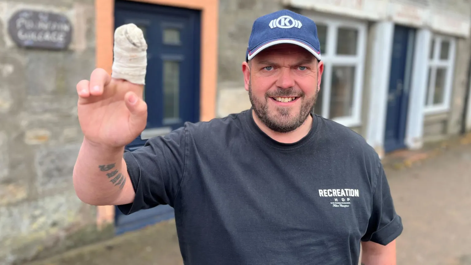 Struan Gunn is in a street. He has designer facial stubble and is wearing a blue cap and a dark blue T-shirt. He is smiling as he holds up a hand with two bandaged fingers.