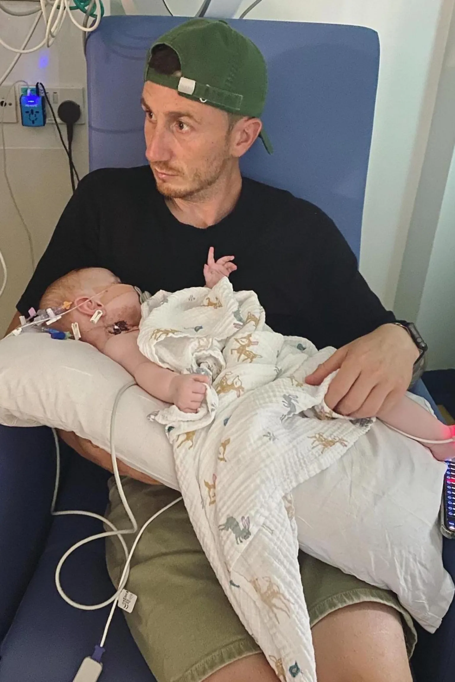 Emily Bowen A man, wearing a black t shirt, beige shorts and backwards green baseball cap. He is sat on a blue chair, in a hospital, and has a cushion on his lap, on top of which lies a baby with several tubes and wires connected to her.