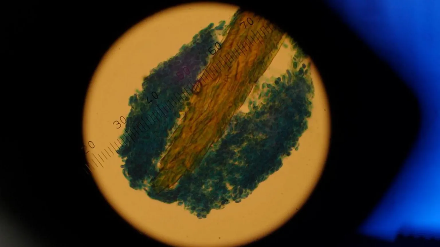 Gwyndaf Hughes/BBC Fungus under the microscope