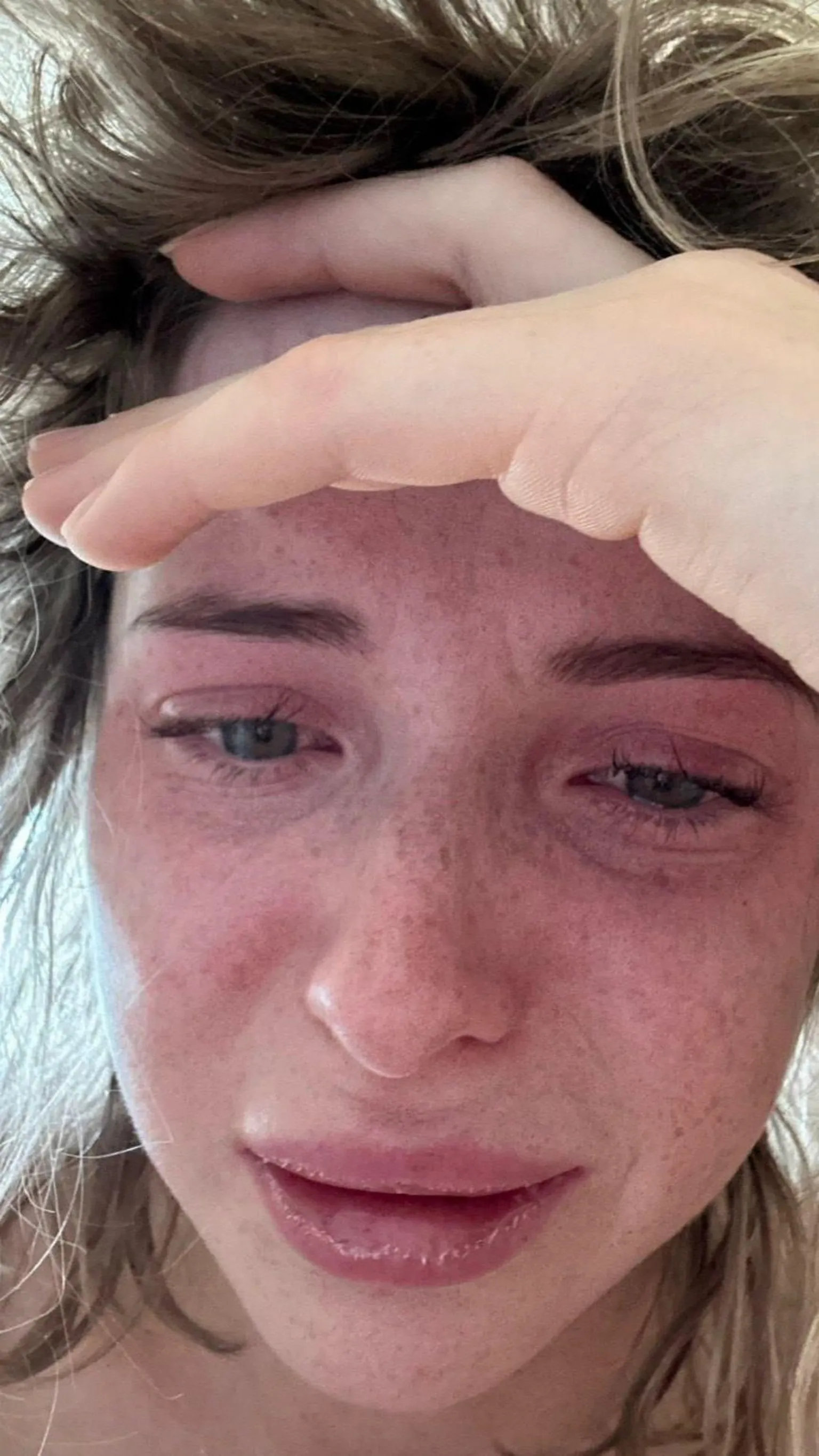 Close-up of Ellie's face with one hand resting across the forehead, partially covering the upper face; fine freckles visible across the skin, slightly tousled hair, and a light background.