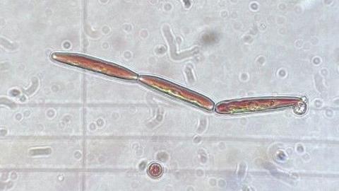The novel Ancylonema alga under a microscope. It is a small cell made up of three long brown segments.
