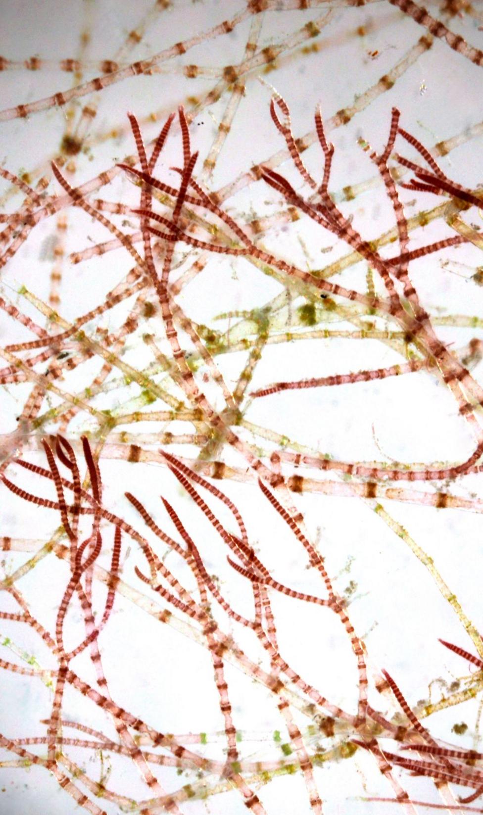 An image of the new species to science under the microscope with its pincer tips, which one diver said look like claws.
