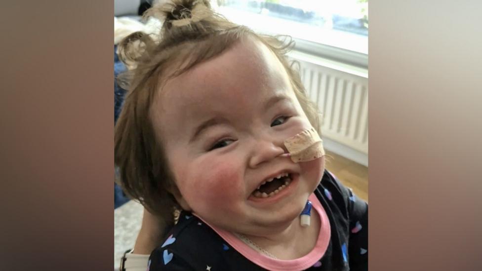 Another image of Lila - this time she has her hair in a bobble on top of her head and is smiling. She's wearing a dark top with a pink border at the neckline. A tube is coming out of one of her nostrils.