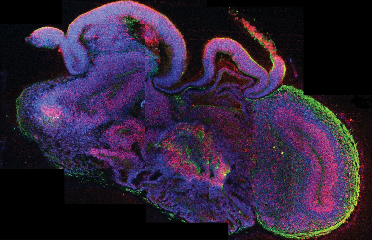 Cross-section of an organoid showing different brain regions with cells in blue, neural stem cells in red, and neurons in green against a black background.