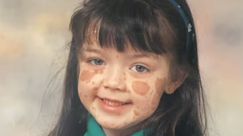 A school picture of Laura Kelly. She is smiling and has long black hair and a hairband. Her birthmarks are visible.