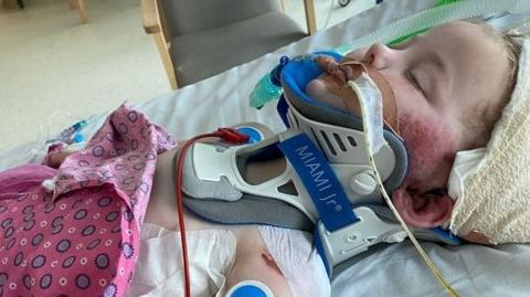 A young girl with a bloodies face, lying down on a hospital bed with lots of coloured wires and tubes attached to her.