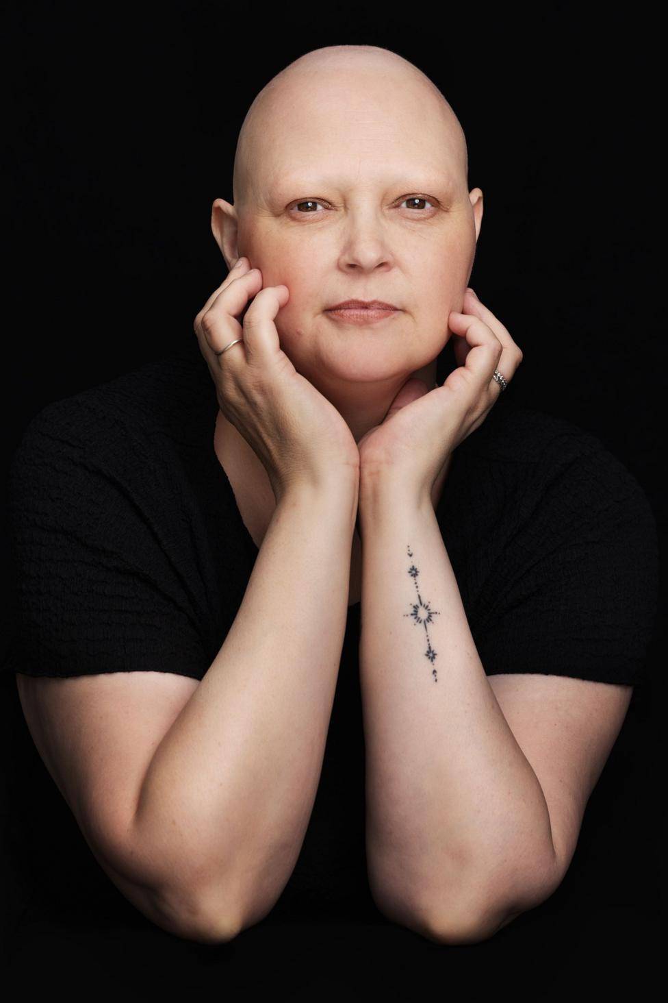 Sam has her face in her hands and looks into the camera. She is bald, wearing a black T-shirt and has a tattoo on her forearm.