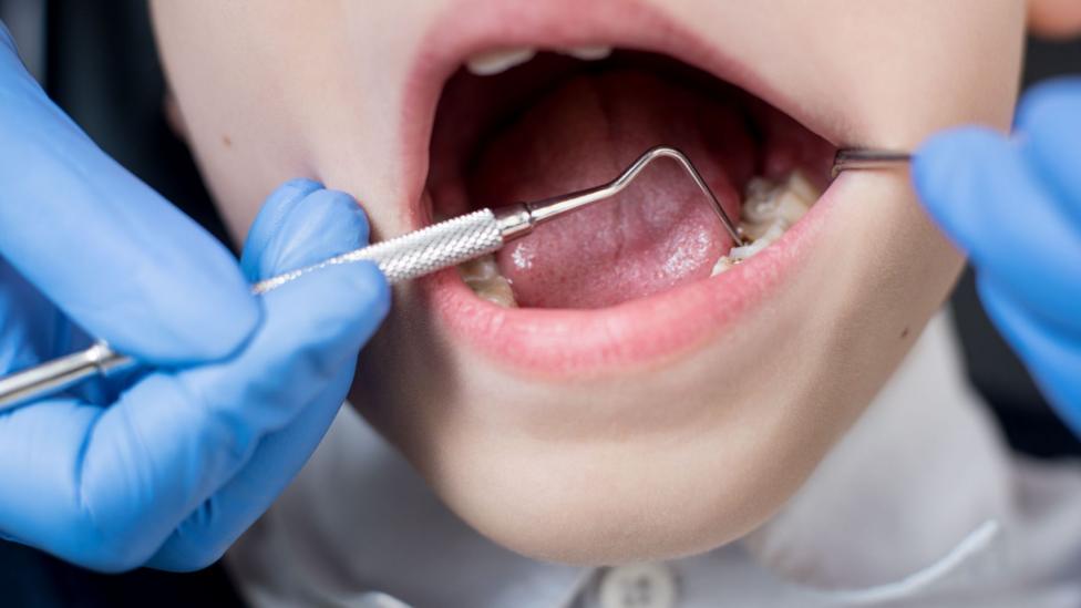 A child's mouth whilst a dentist looks inside
