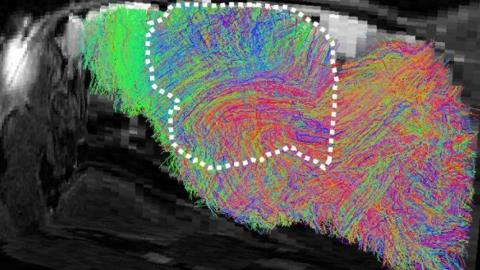 The image shows a scan of the brain of one of the mice that has been implanted with human brain cells. What looks like a chaotic map of differently coloured lines shows the nerve fibre pathways.