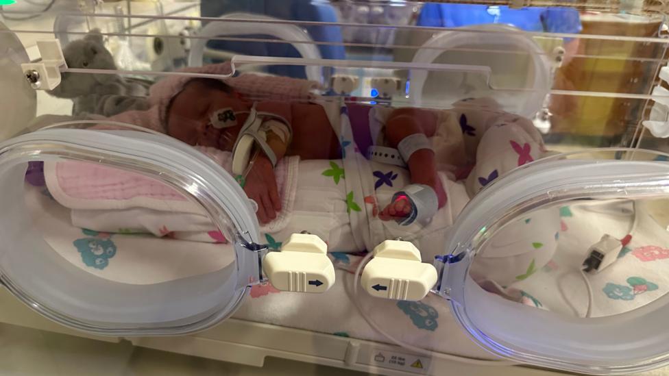 A small premature baby is in an intensive care incubator with a number of tubes helper her to survive