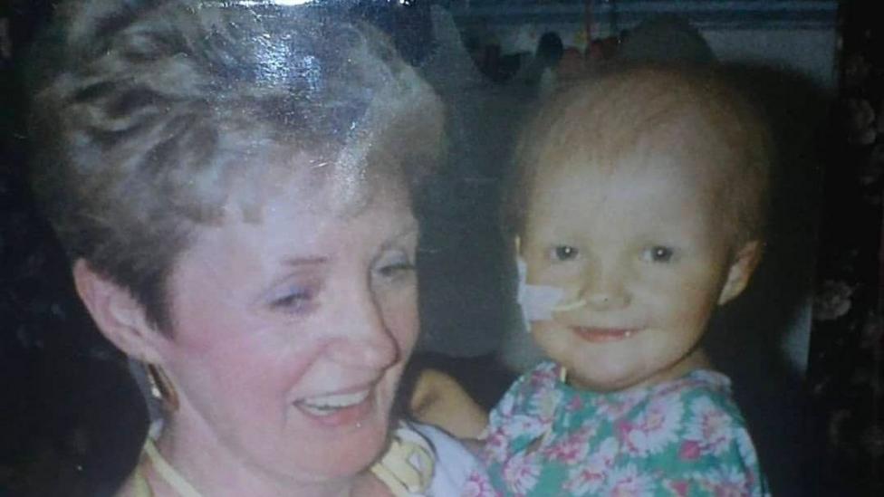A woman holds a young baby in her arms. The baby is smiling into the camera but also has a tube going into her nose and plasters or bandages on her face.