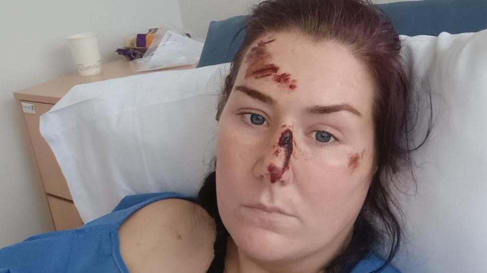 A woman with long dark hair is looking into the camera while lying on a hospital bed. She is wearing blue scrubs. Her forehead, nose and left cheek are covered with deep red scratches.