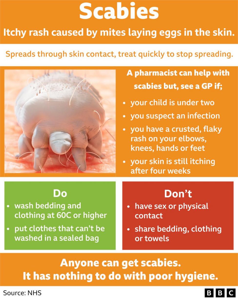 Graphic of scabies symptoms and care. It urges people to see a GP for help with scabies if your child is under two, if you suspect an infection, if you have a crusted, flaky rash on your elbows, knees, hands or feet, or if your skin is still itching after four weeks. It tells people to wash bedding and clothing at 60C or higher, and put clothes that can't be washed in a sealed bag. It says do not have sex or physical contact or share bedding, clothing or towels.