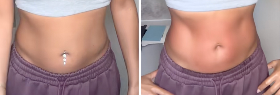 A before and after stomach lymphatic drainage massage image of a slim young woman with long dark curly hair wearing a grey sports bra and purple joggers. In the before photo on the left her tummy seems slightly rounded and she is wearing a belly button piercing. In the after photo on the right she does not have the piercing in, her tummy is slightly red and appears flatter with some abs definition