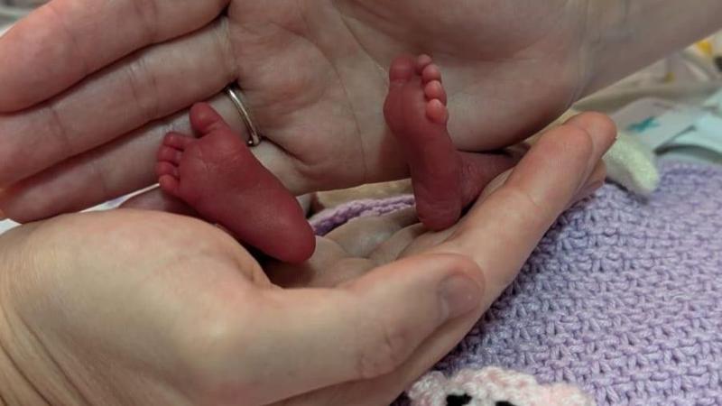 Millie's feet in between two hands.