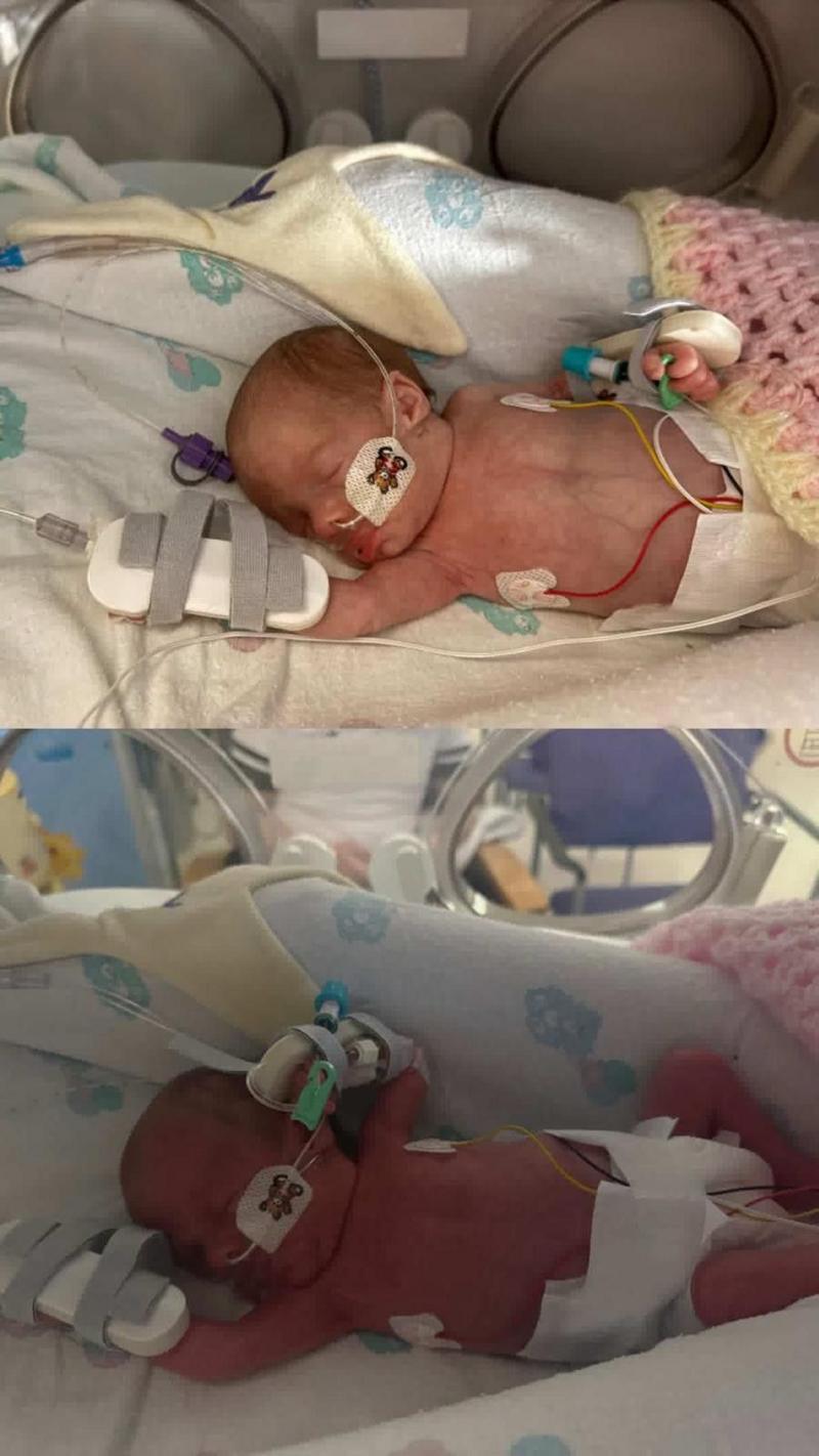 Millie in an incubator in a hospital. The top image is before the blood transfusion and the second is after. 