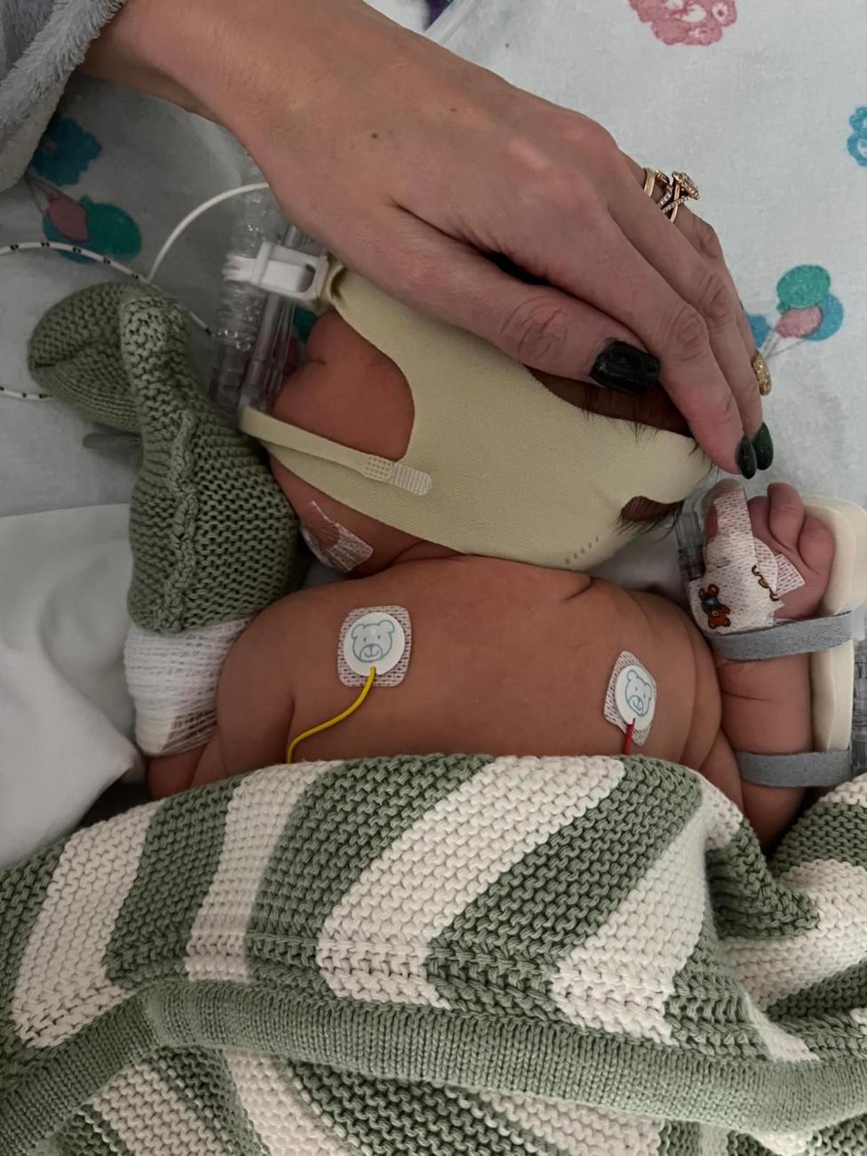 Newborn Phoebe lying on a hospital cot, partially covered with a green-and-white knitted blanket. The baby is wearing medical monitoring leads, a respiratory support mask secured with a soft headband, and protective mittens. An adult hand rests gently on the baby's head. The hospital bedding has a subtle balloon pattern in the background.