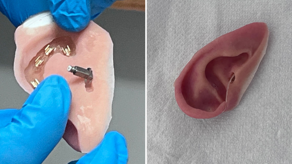 Two pictures side by side - the back of a prosthetic ear being held by blue gloves and the front of the ear, sitting on tissue, showing the attachment for a hearing aid