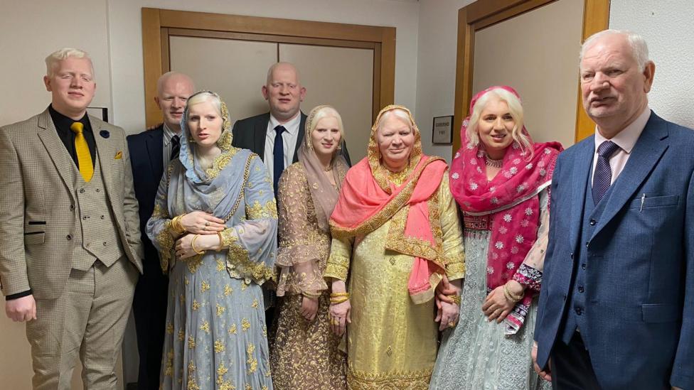 Six siblings, three men and three women, have white hair and eyelashes and are standing around either side of their mother, who also has white hair, and their father who is wearing a navy suit.